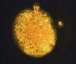 An egg that was stained with a dye that appears yellow in a fluorescence microscope. It shows the egg and the first polar body on the right side. At the top, the small second polar body is just forming. yellow egg