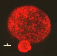 An unfertilized egg stained with a dye that appears red in a fluorescence microscope. It shows the large egg and the small first polar body at the bottom. The small line indicating size is 10 micrometers long = 1/100 of a millimeter. The egg is about 100 micrometers in diameter, so about ten eggs would fit side to side on a pencil line. red egg
