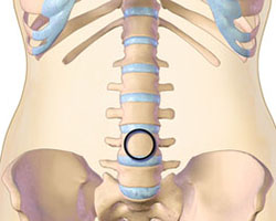 spine and legs