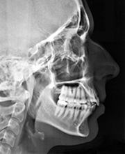 xray