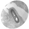 listeria