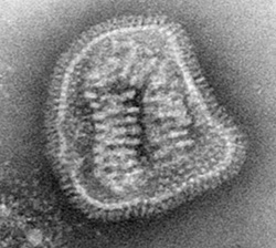 Transmission electron micrograph image of a virus. Transmission electron micrograph image of a virus.