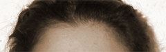widow's peak hairline