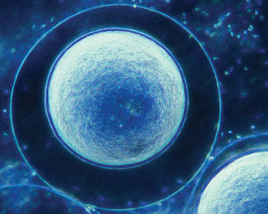 Photo courtesy of Doug Chandler urchin eggs