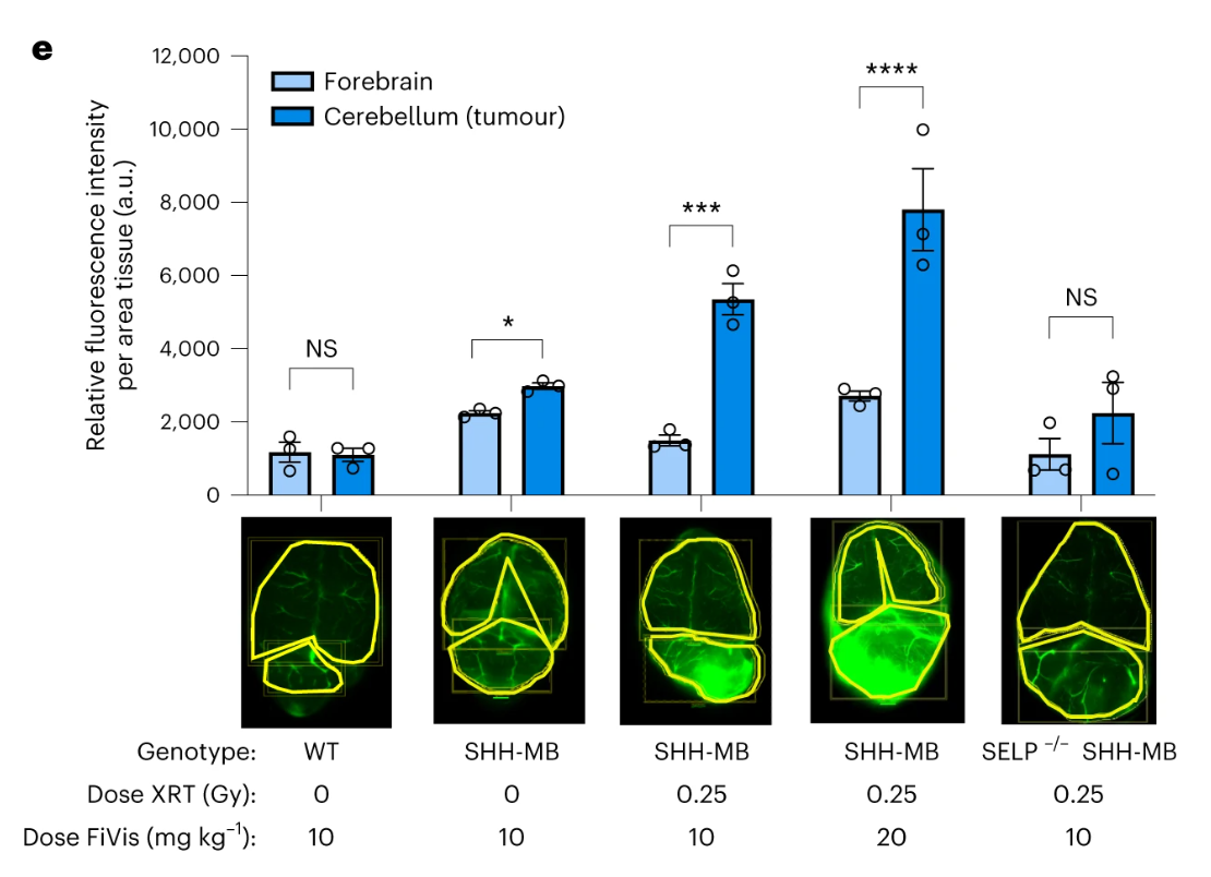 Graph of brain cancer barrier treatment