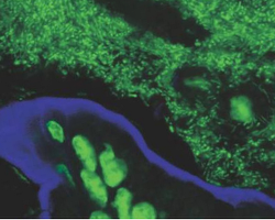 Gut bacteria of a mouse