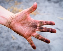 palm of a dirty hand