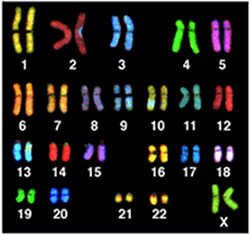 Human Karyotype female