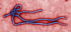 Ebola virus virion