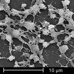Taking a closer look at biofilms with an electron microscope. The sticky-looking substance between the round cocci bacteria are the biofilms. Scientists have found these films make it harder to treat and kill bacteria when using drug treatments like antibiotics. electron microscope image of Staphylococcus aureus bacteria (CDC Image)