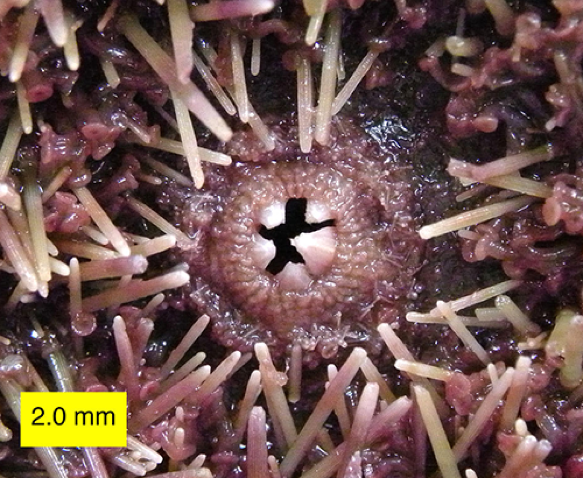 Sea urchin teeth