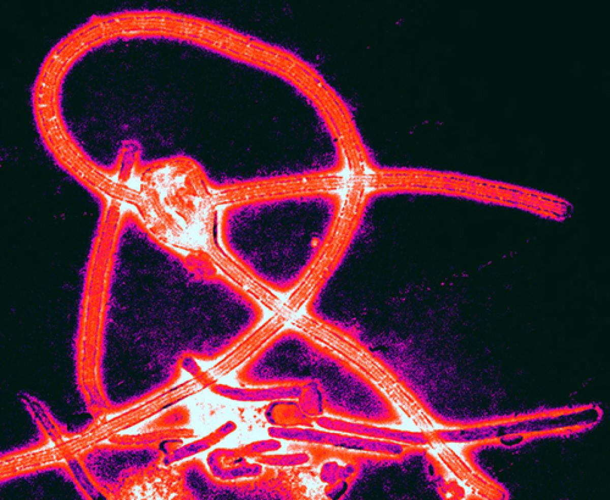 ebola virus