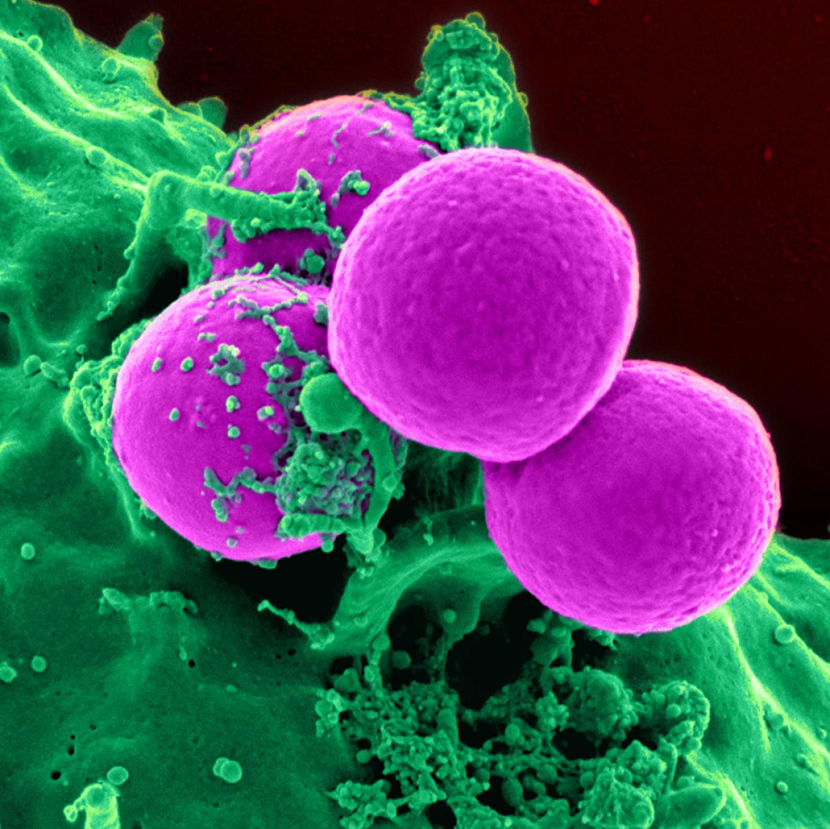 Human Neutrophil ingesting MRSA
