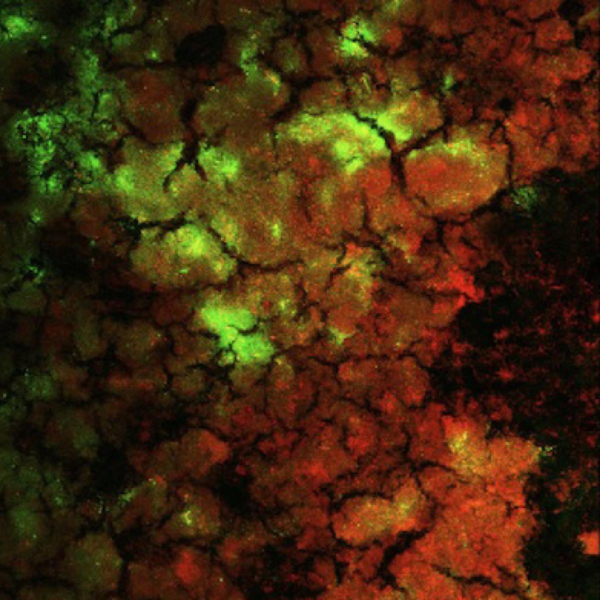 Intraorally Developed Biofilm