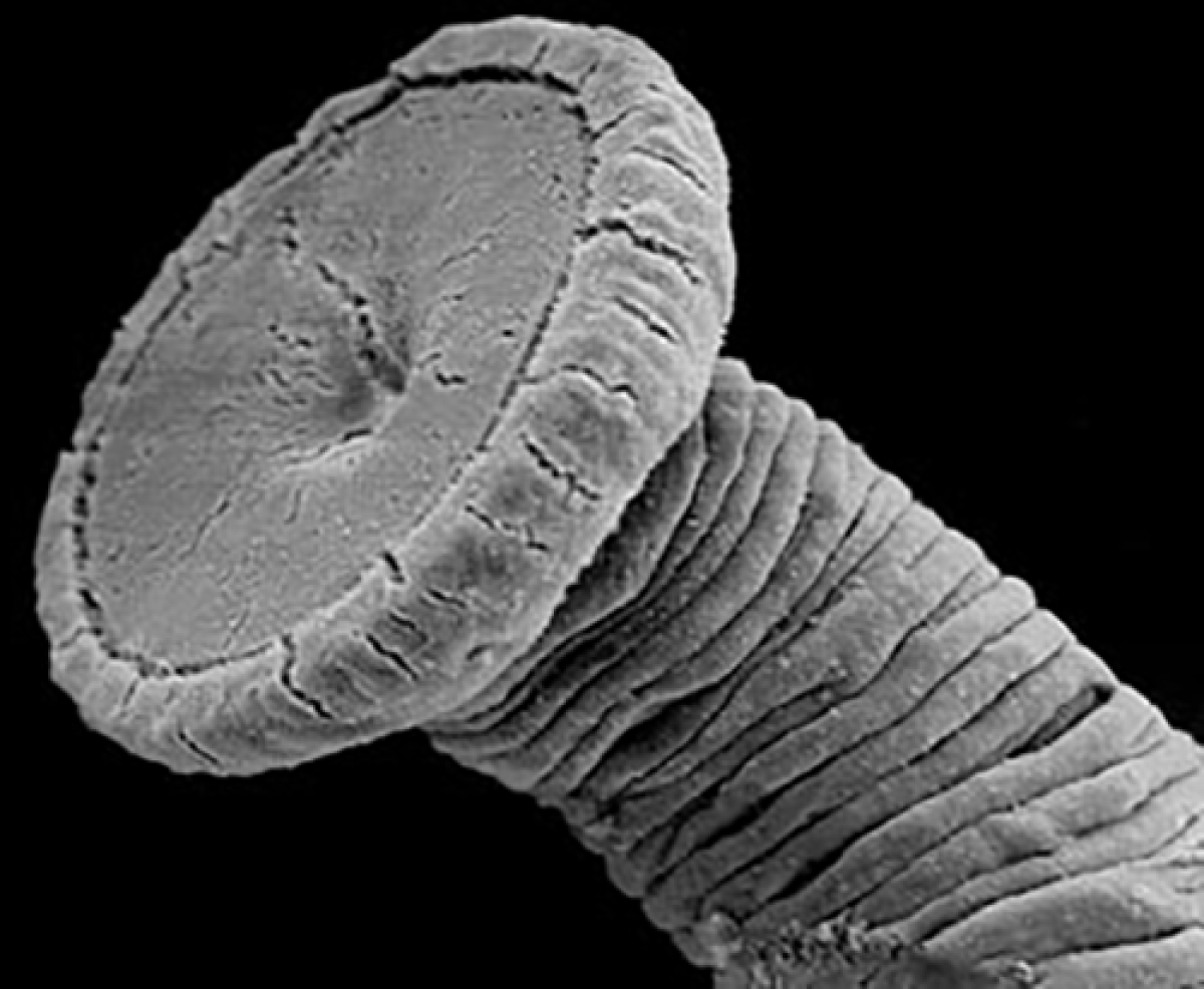 Microscopic view of fubefeetsem